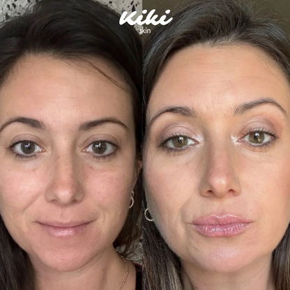 LipBoost - Kit Volume & Idratazione Labbra✨